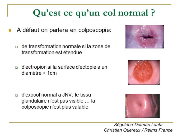 Diapositive6